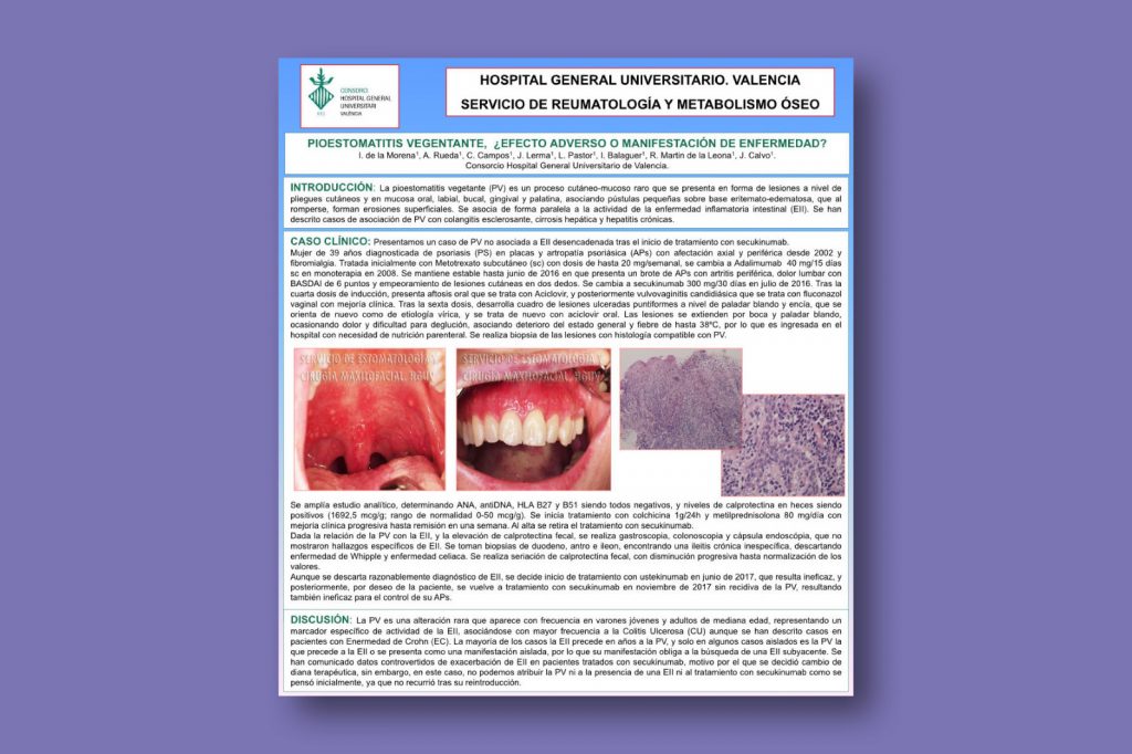 Pioestomatitis vegentante, ¿efecto adverso o manifestación de enfermedad?