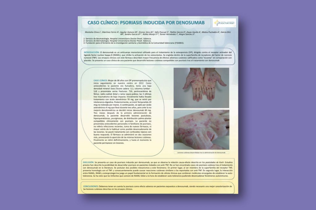 Caso clínico: Psoriasis inducida por Denosumab