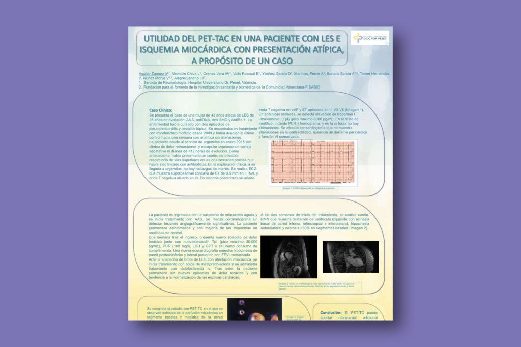 Utilidad del PET-TAC en una paciente con LES e Isquemia Miocárdica con presentación atípica, a propósito de un caso