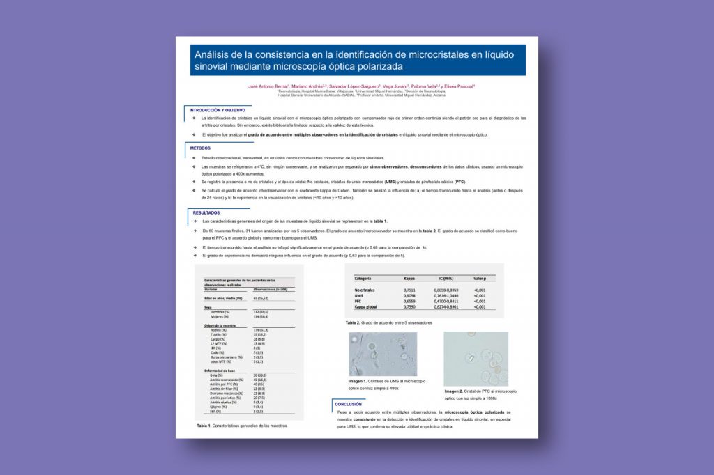 Análisis de la consistencia en la identificación de microcristales en líquido sinovial mediante microscopía óptica polarizada