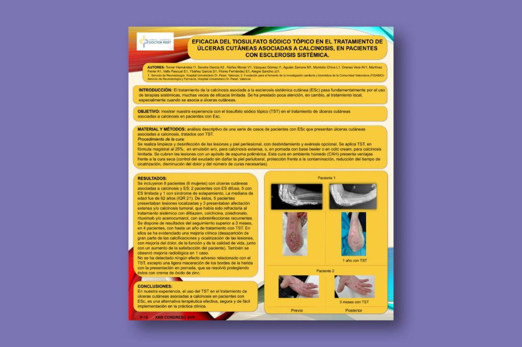 Eficacia del tiosulfato sódico tópico en el tratamiento de úlceras cutáneas asociadas a calcinosis, en pacientes con esclerosis sistémica