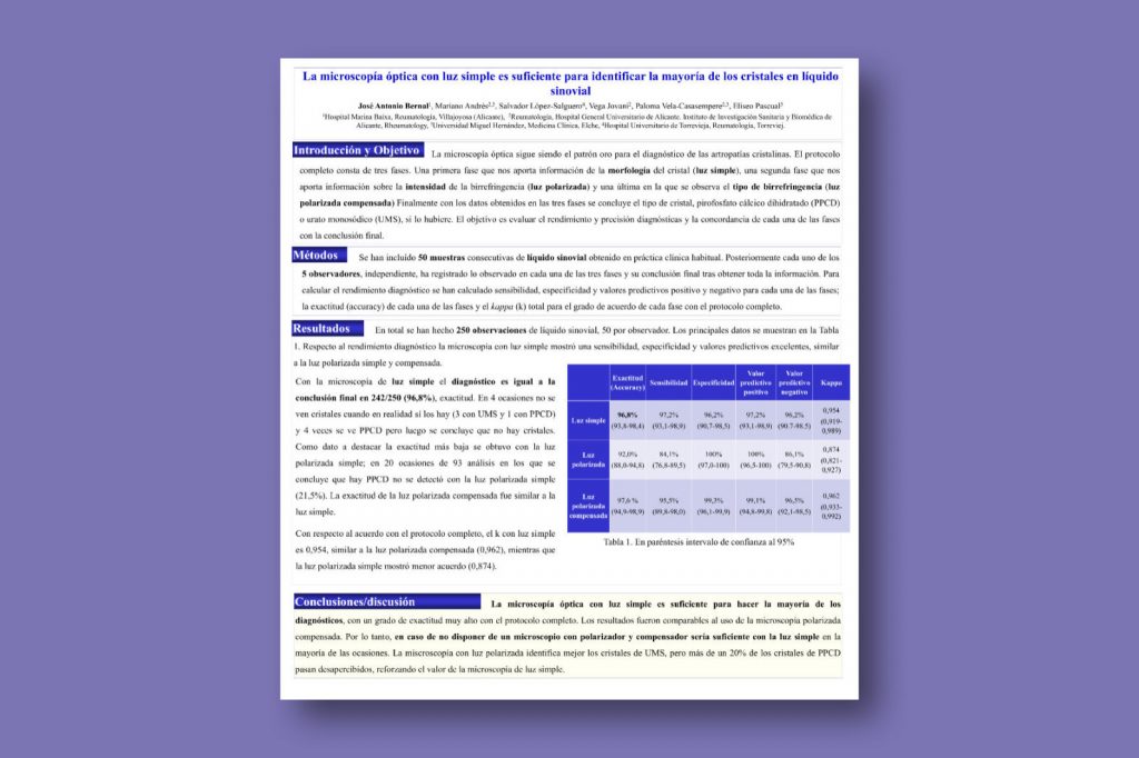 La microscopía óptica con luz simple es suficiente para identificar la mayoría de los cristales en líquido sinovial