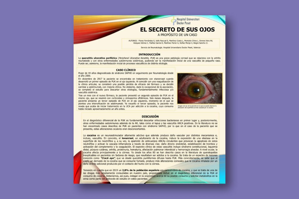 El secreto de sus ojos. A propósito de un caso